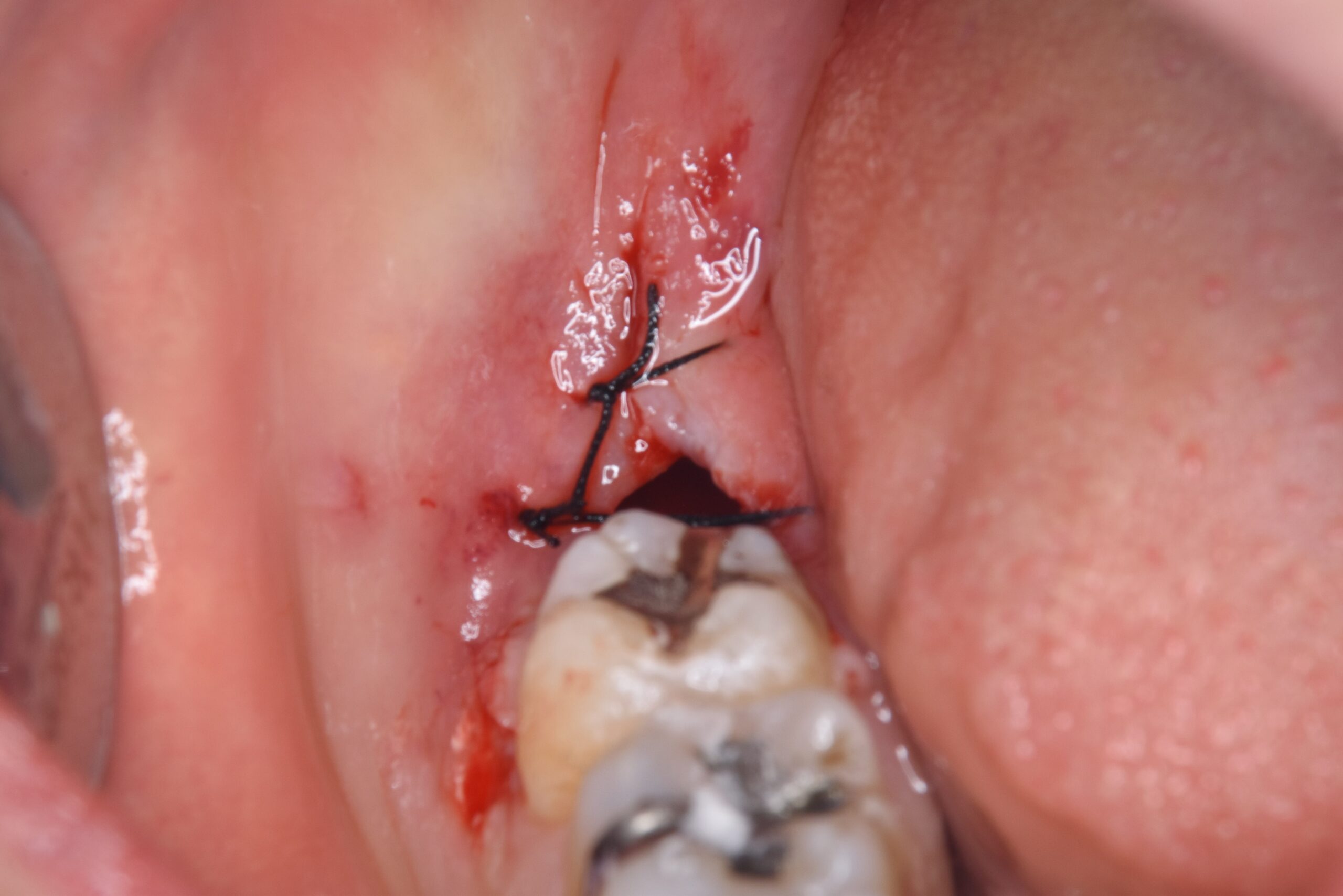 case1-a