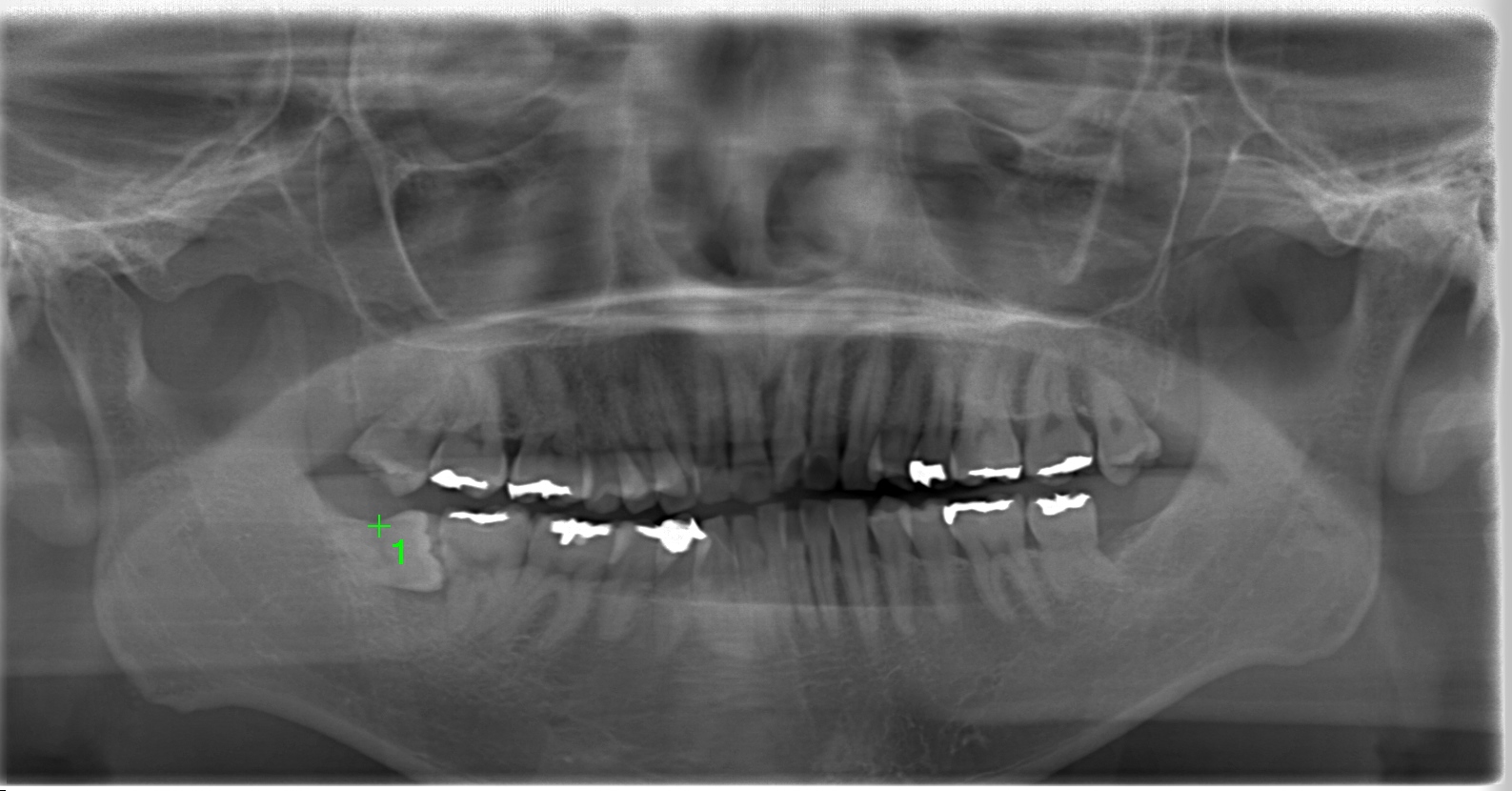 case1-b