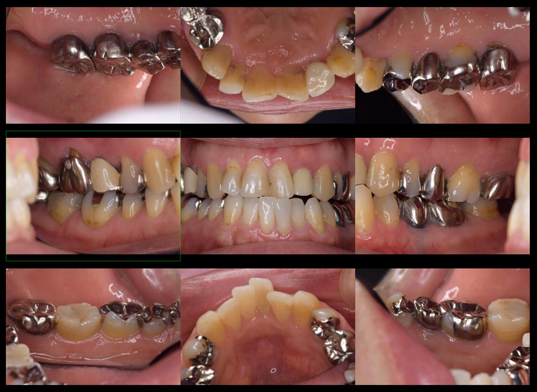 case2-a