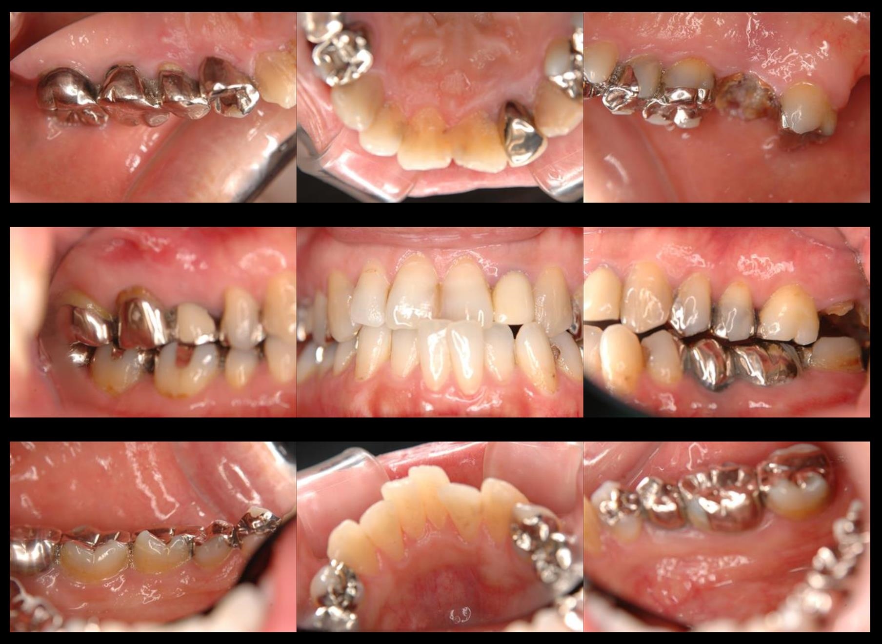 case2-b
