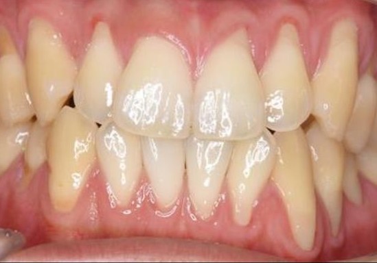 case4-b