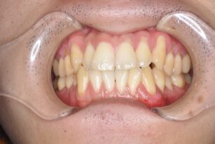case4-thum