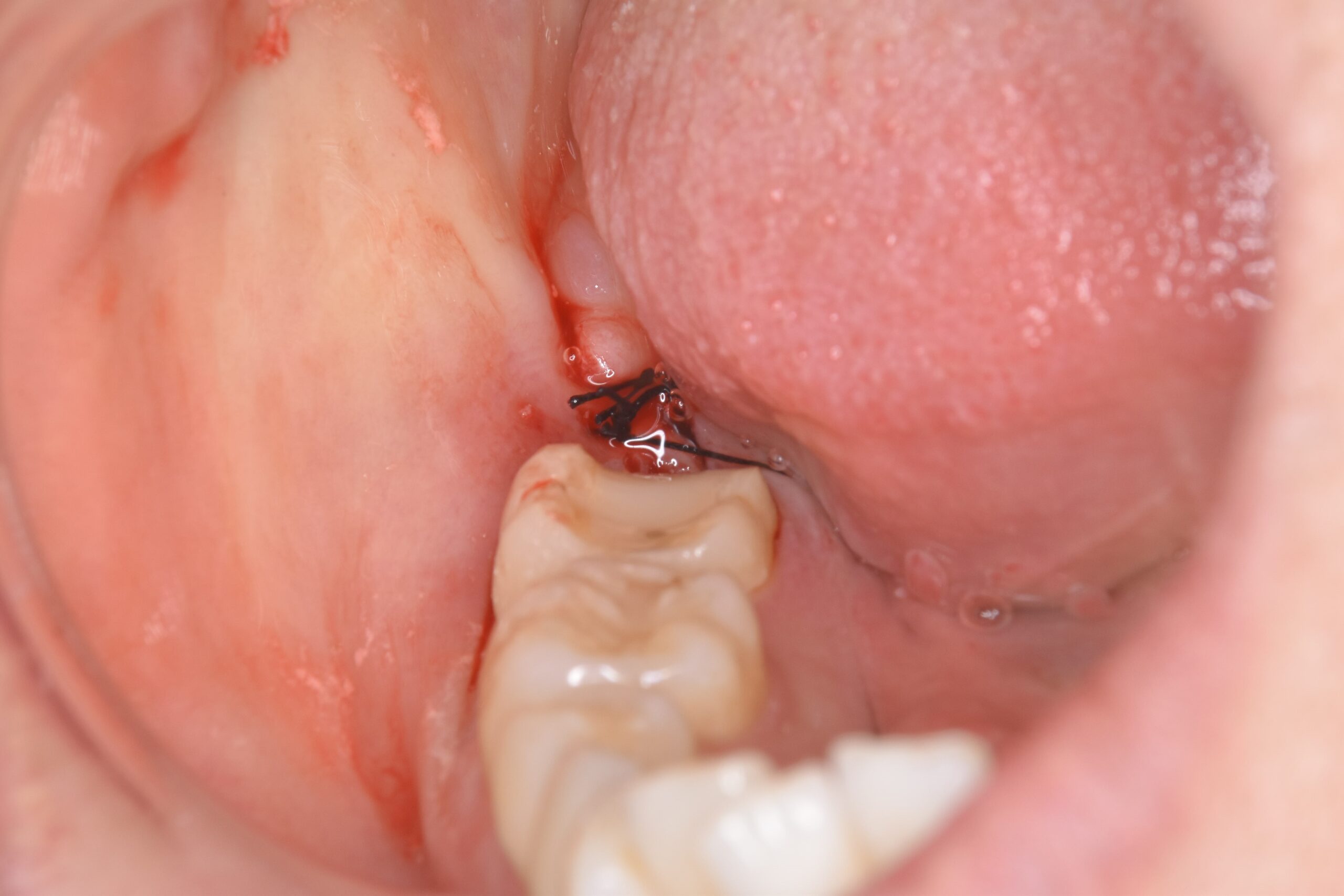 case10-a