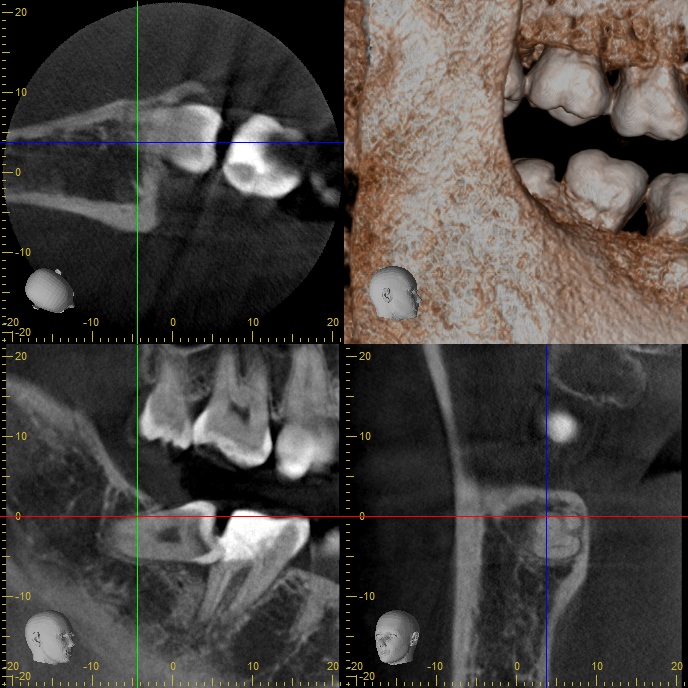 case10-b