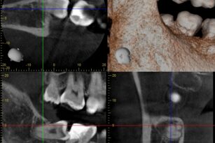 case10-thum