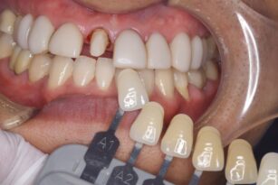 case12-b