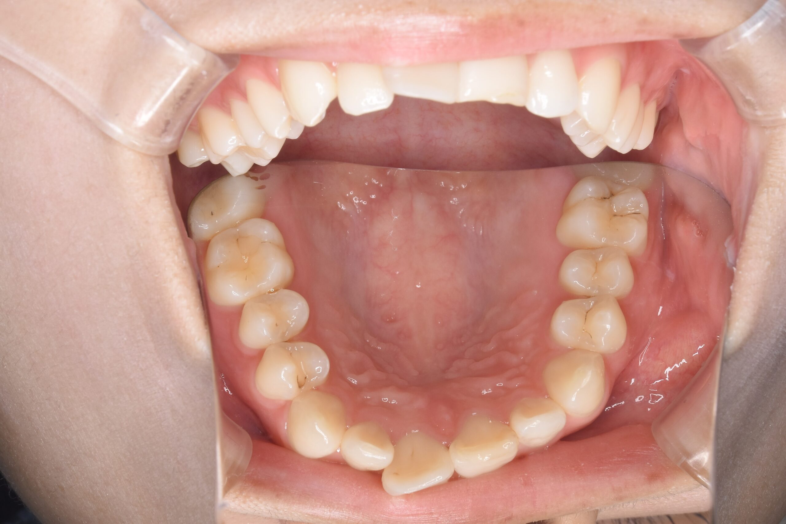 case19-b