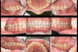 case19-thum