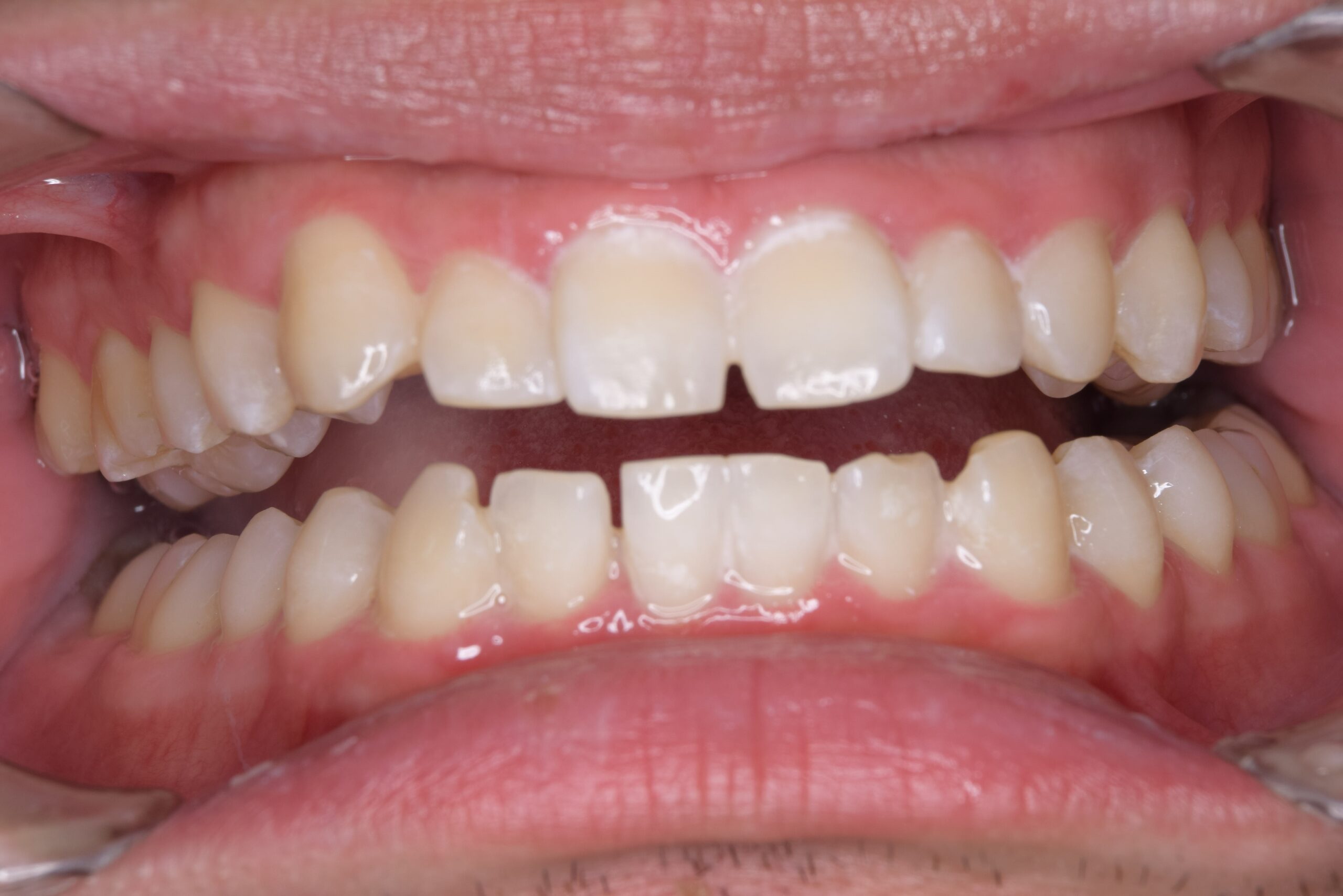 case5-a