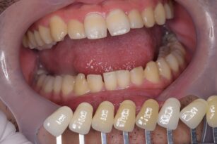case5-thum