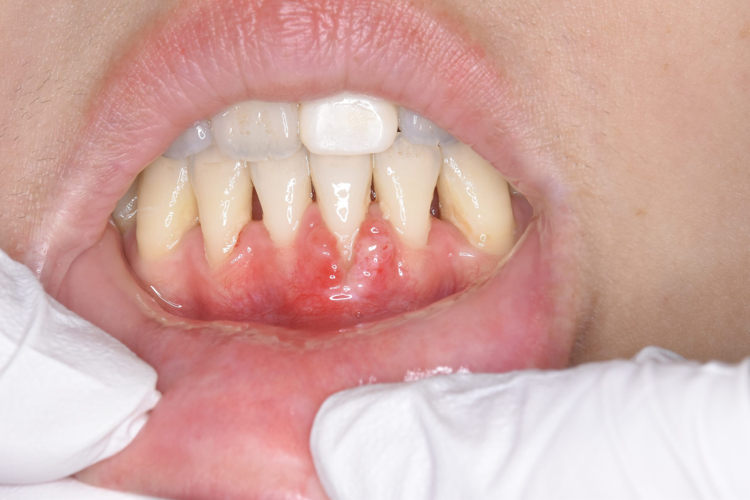 case6-a
