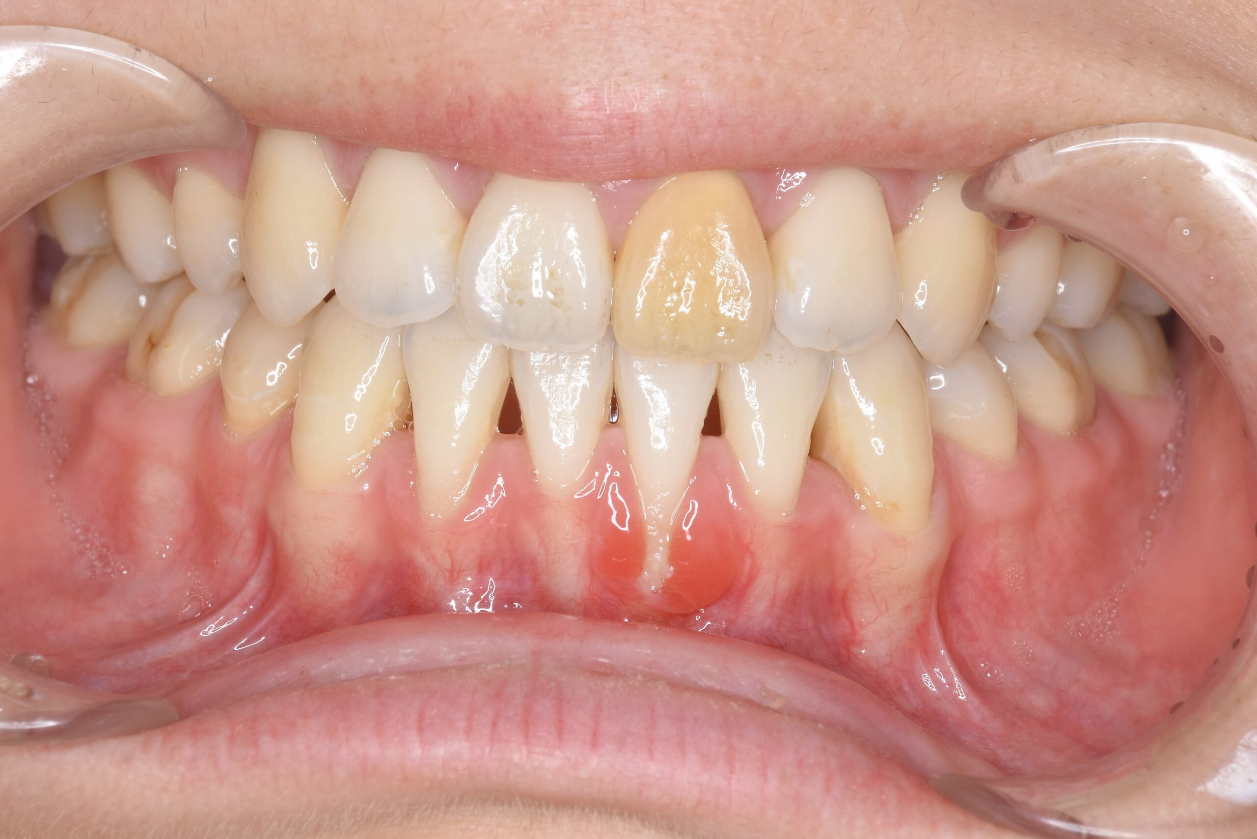 case6-b