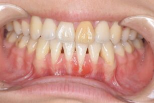 case6-thum