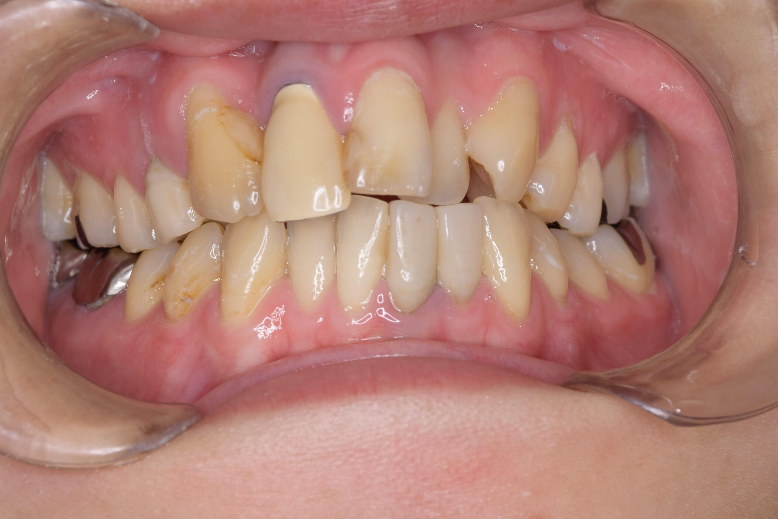 case7-b