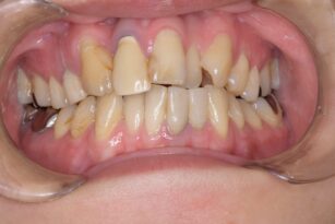 case7-thum