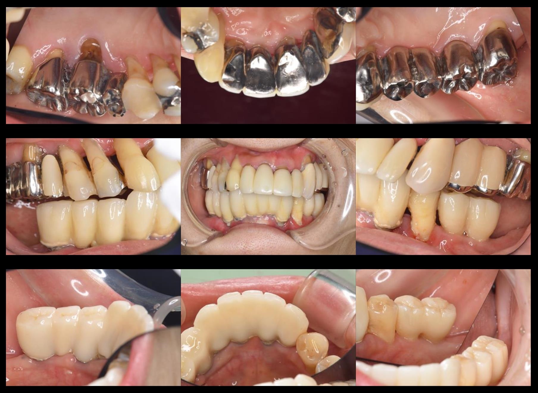 case20-a