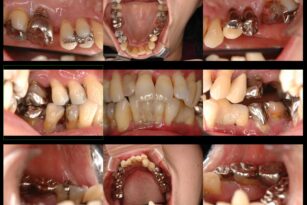 case20-b