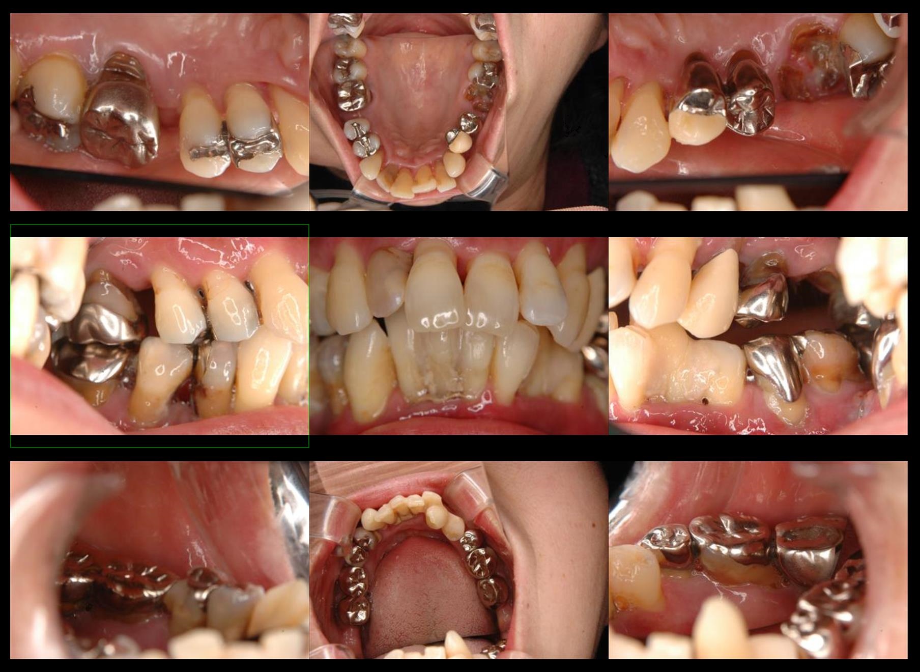 case20-b