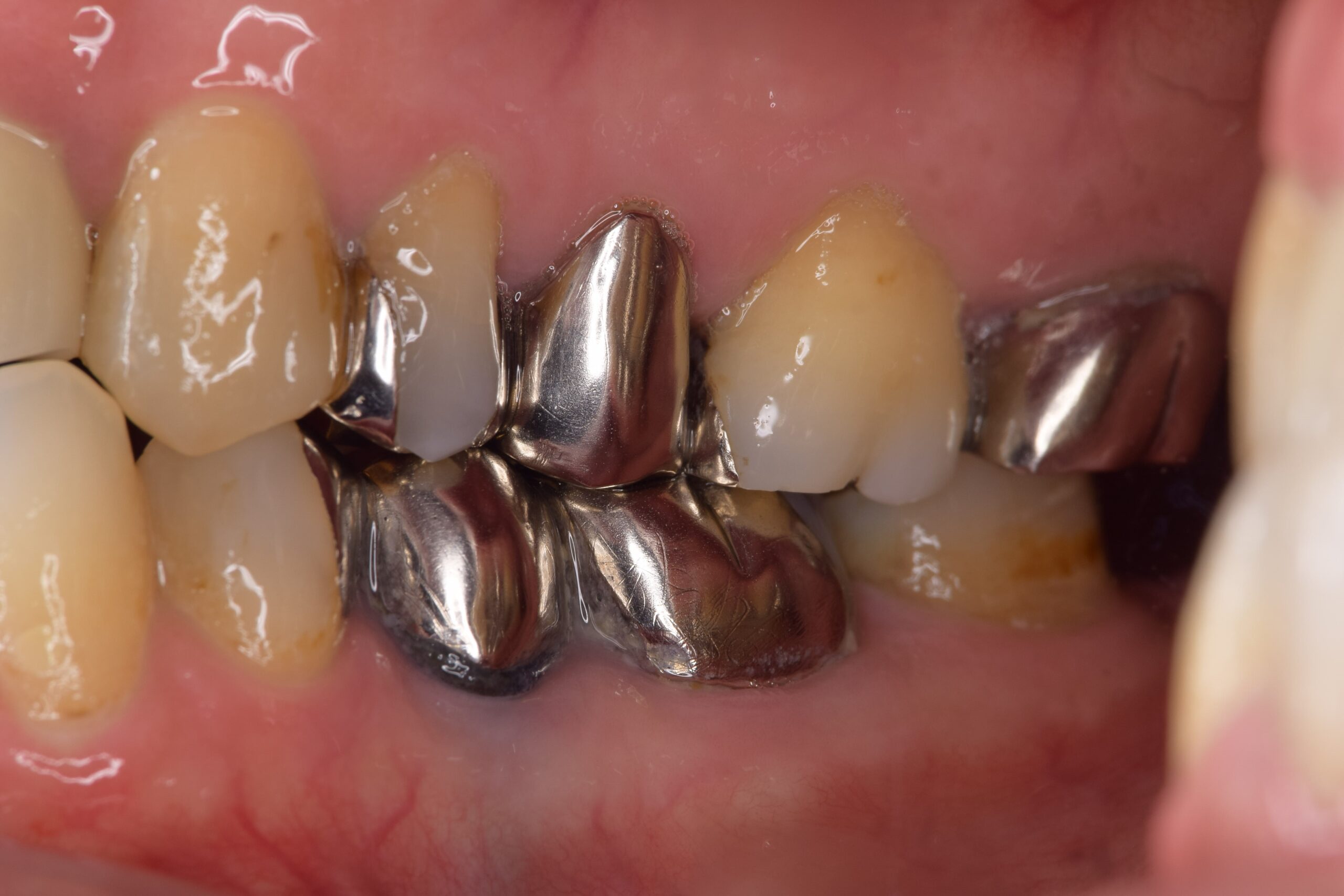 case21-a