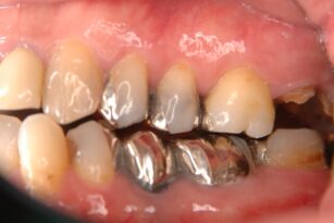 case21-b