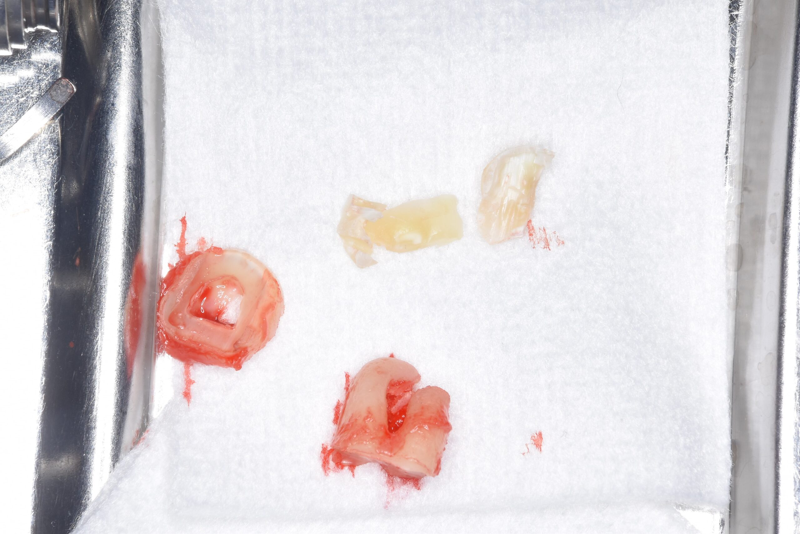 case23-a