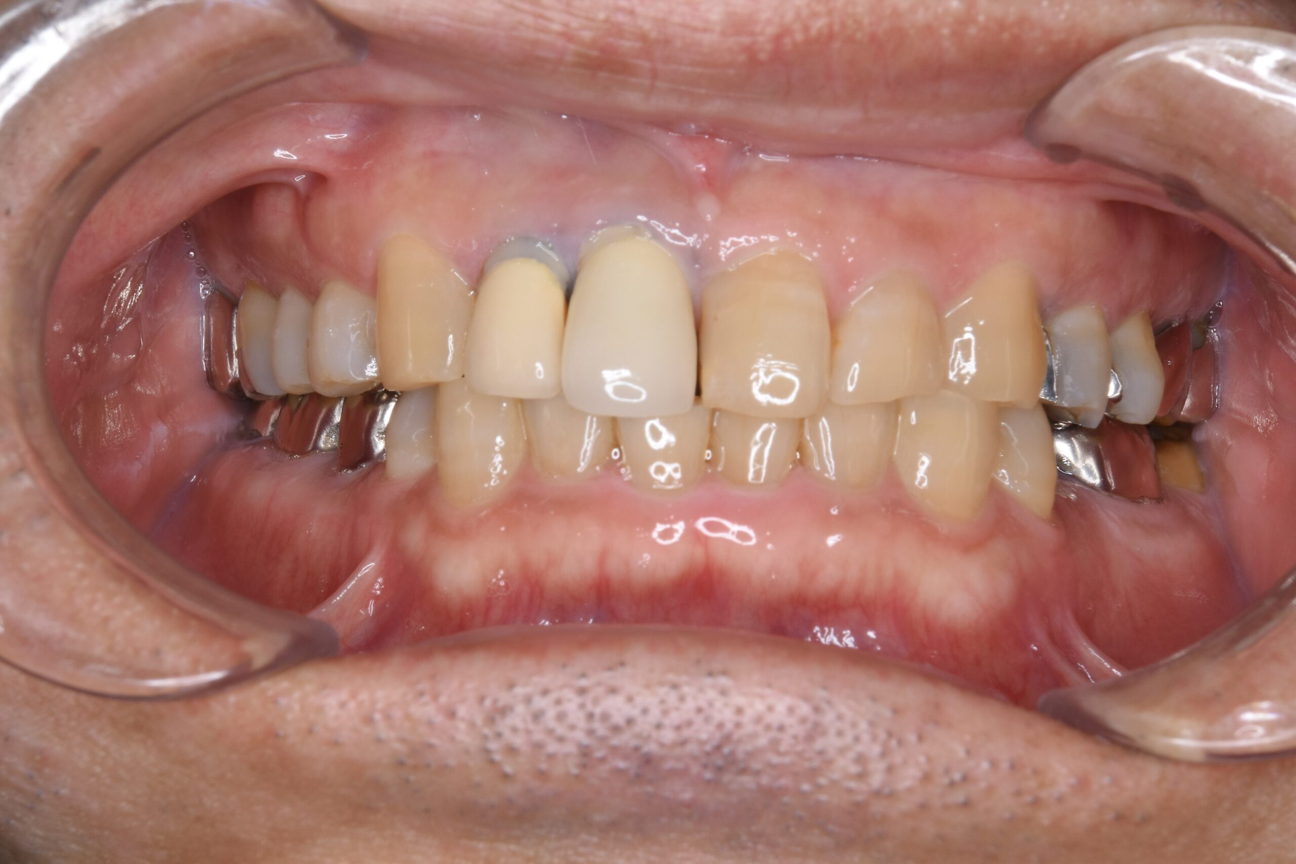 0000003578_杉田 智_Camera_20211108114737