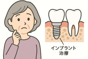 インプラント治療
