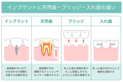 やまのうち歯科医院-宇都宮-歯医者-歯周病-インプラント-ホワイトニング-矯正-セラミック-審美　入れ歯　ブリッジ