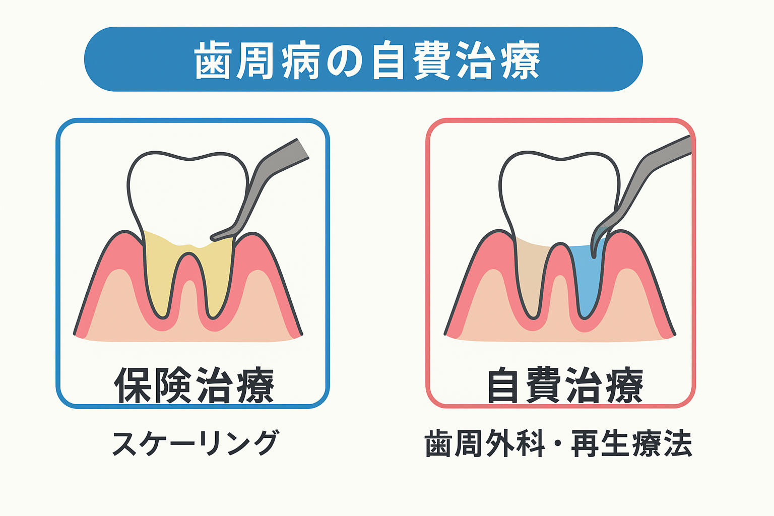 やまのうち歯科医院　宇都宮　歯医者　歯周病　インプラント　ホワイトニング　矯正　入れ歯　マイクロスコープ レーザー治療　CT撮影　小児歯科