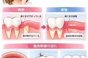 宇都宮　やまのうち歯科院　歯周病　矯正　歯肉移植　歯医者　インプラント