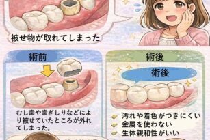 宇都宮　歯医者　やまのうち歯科医院　雀宮　歯周病　矯正　インプラント　入れ歯2