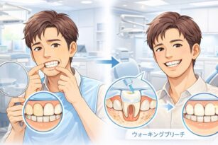 宇都宮　歯周病　ホワイトニング　歯医者　インプラント