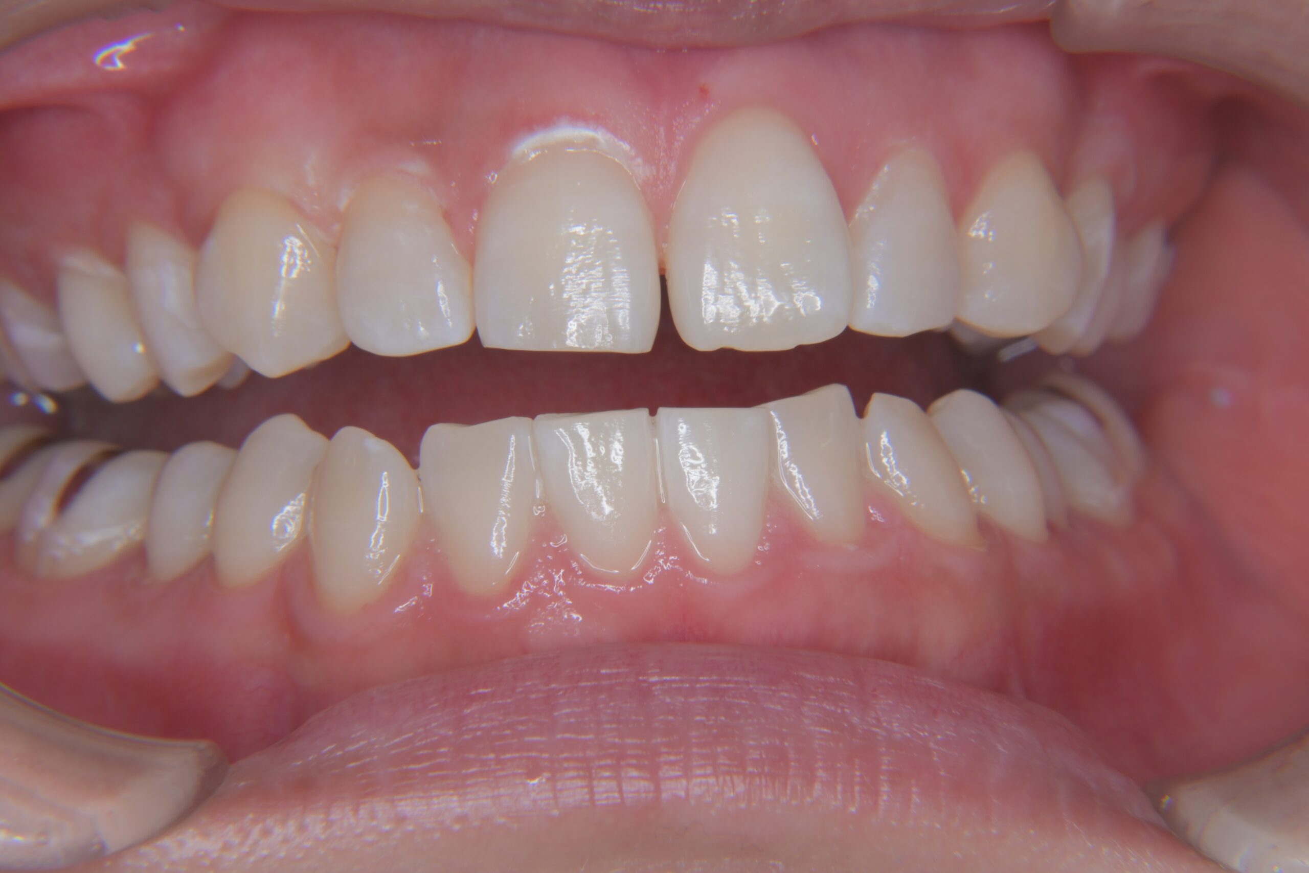 矯正　宇都宮　歯周病　インプラント　歯並び　抜歯　歯医者　求人　ホワイトニング　21