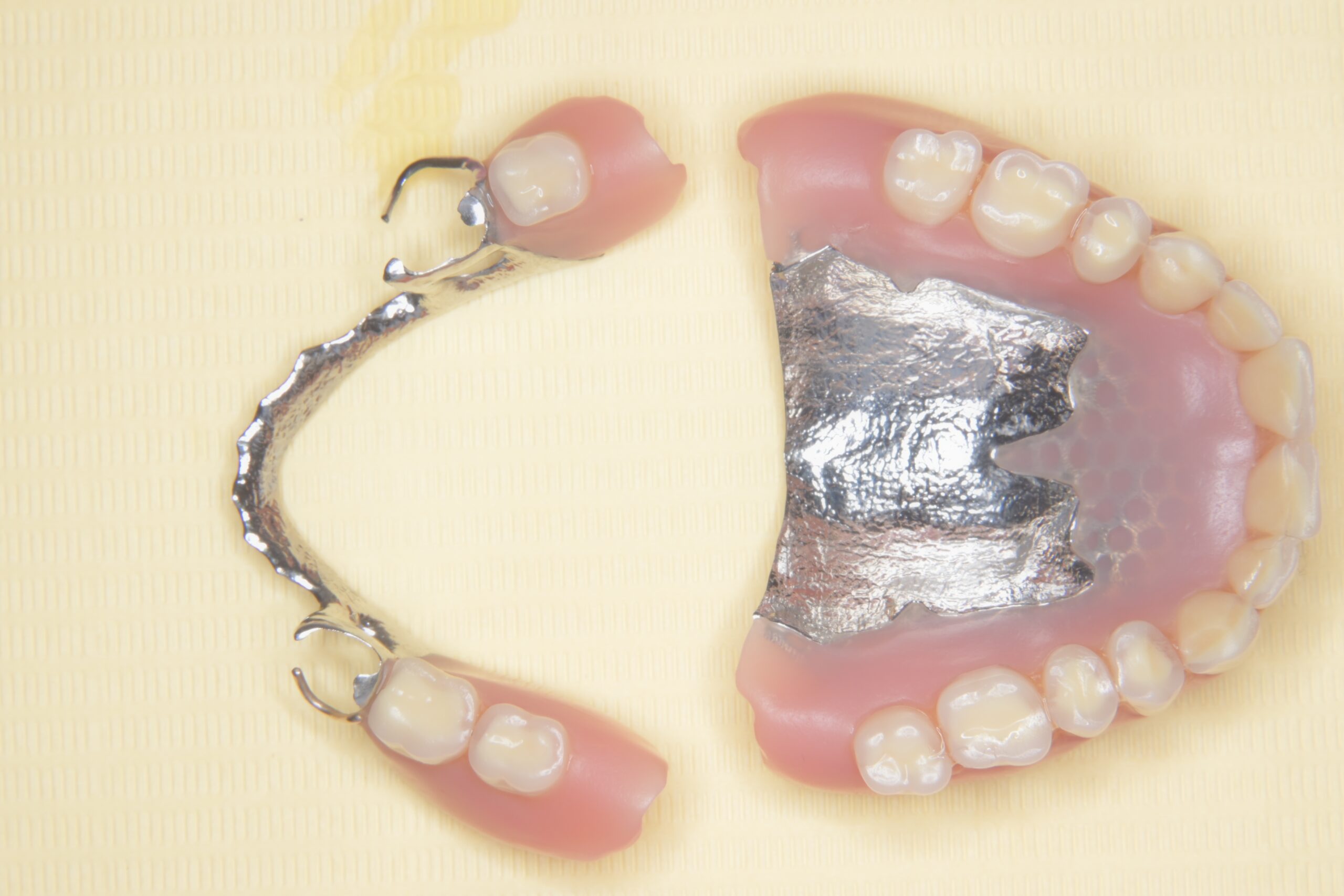 宇都宮 歯医者 入れ歯 自費 歯周病 予防 虫歯 4