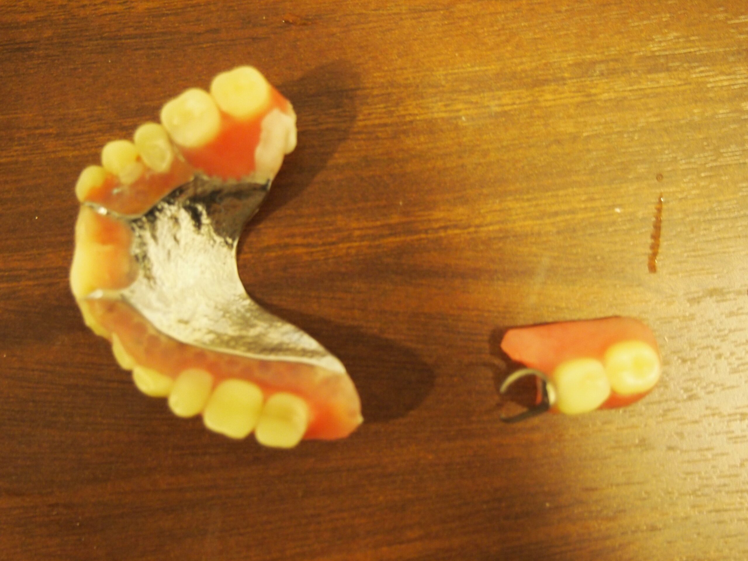 宇都宮 歯医者 入れ歯 自費 歯周病 予防 虫歯 6