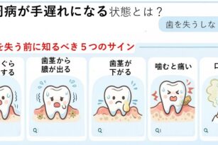 宇都宮　歯医者　やまのうち歯科医院　雀宮　歯周病　矯正　インプラント　入れ歯36