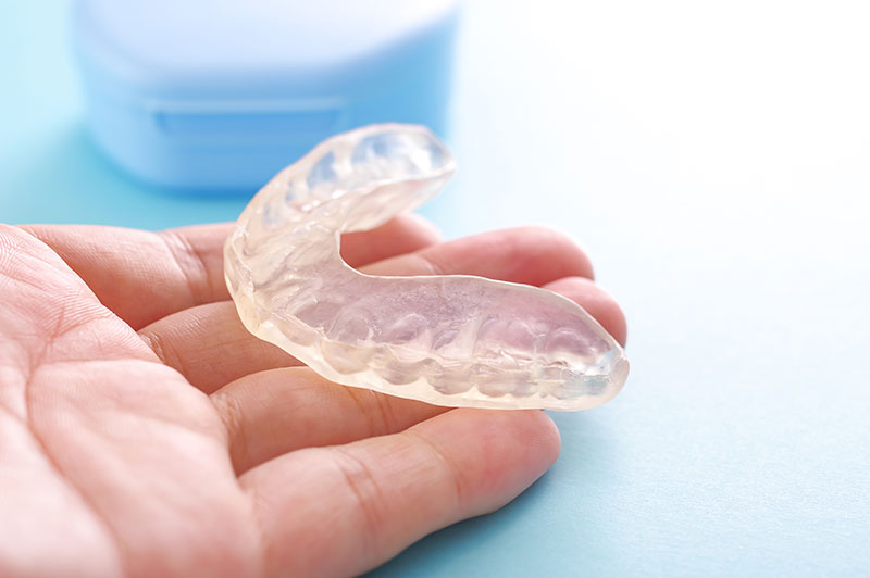 マウスピース(ナイトガード)|やまのうち歯科医院