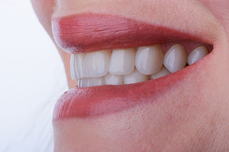 TCH(歯の接触癖)とは|やまのうち歯科医院