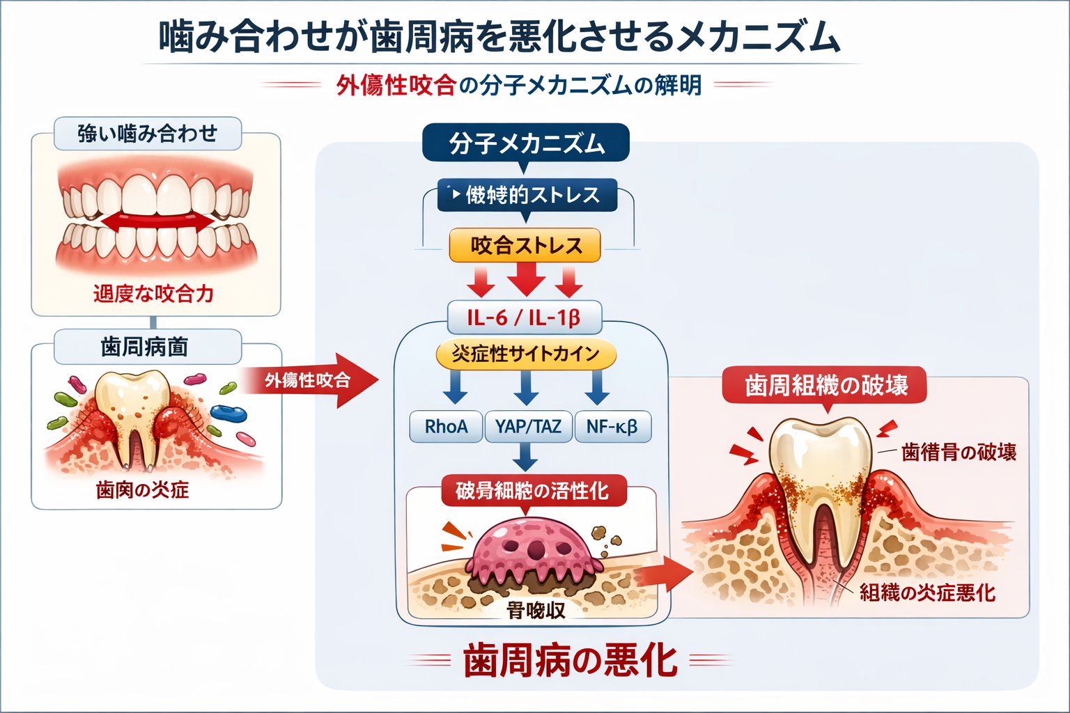 噛み合わせが歯周病を悪化させる？研究で解明した「外傷性咬合」の分子
